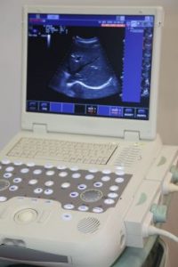 12479178 - medical equipment ultrasound scanning. diagnosis of pregnancy. focus on keyboard.