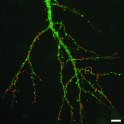 Quantum dot imaging advances