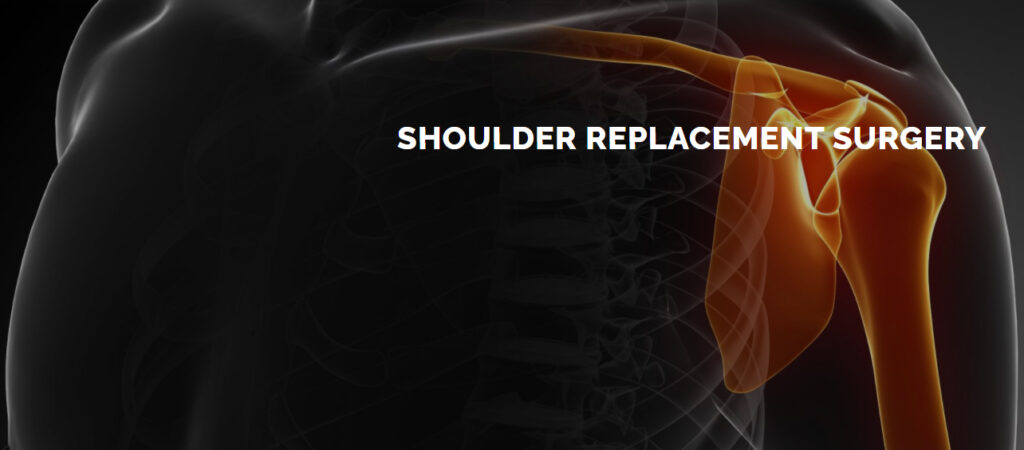 Shoulder Innovations